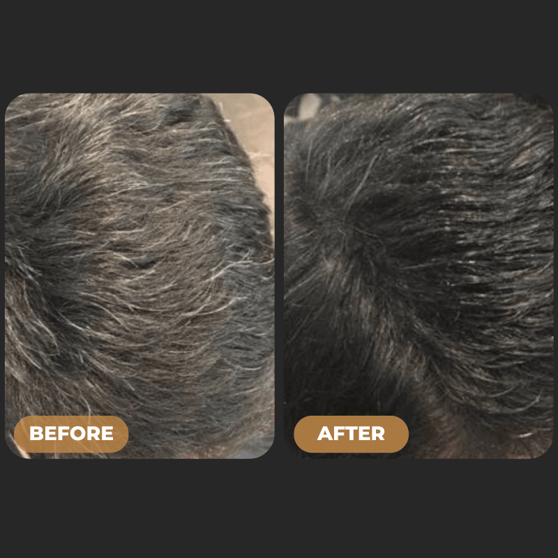 SPARTAN™ - Gray Hair Reverse Bar