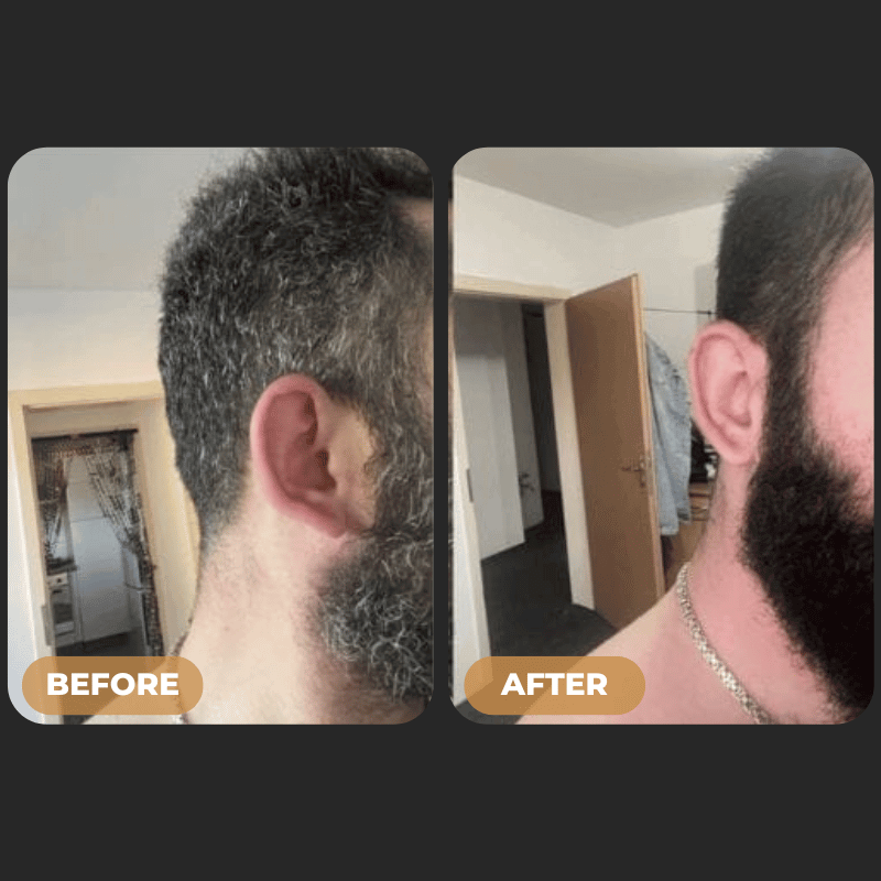 SPARTAN™ - Gray Hair Reverse Bar