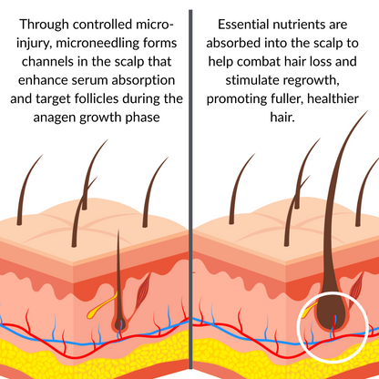 SPARTAN Advanced Micro - Infusion Hair Regrowth Kit