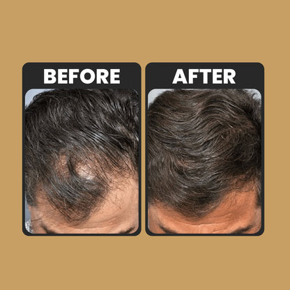 Root Activator Conditioner