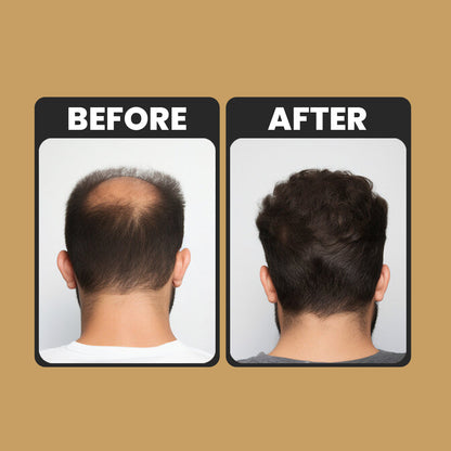 Root Activator Conditioner