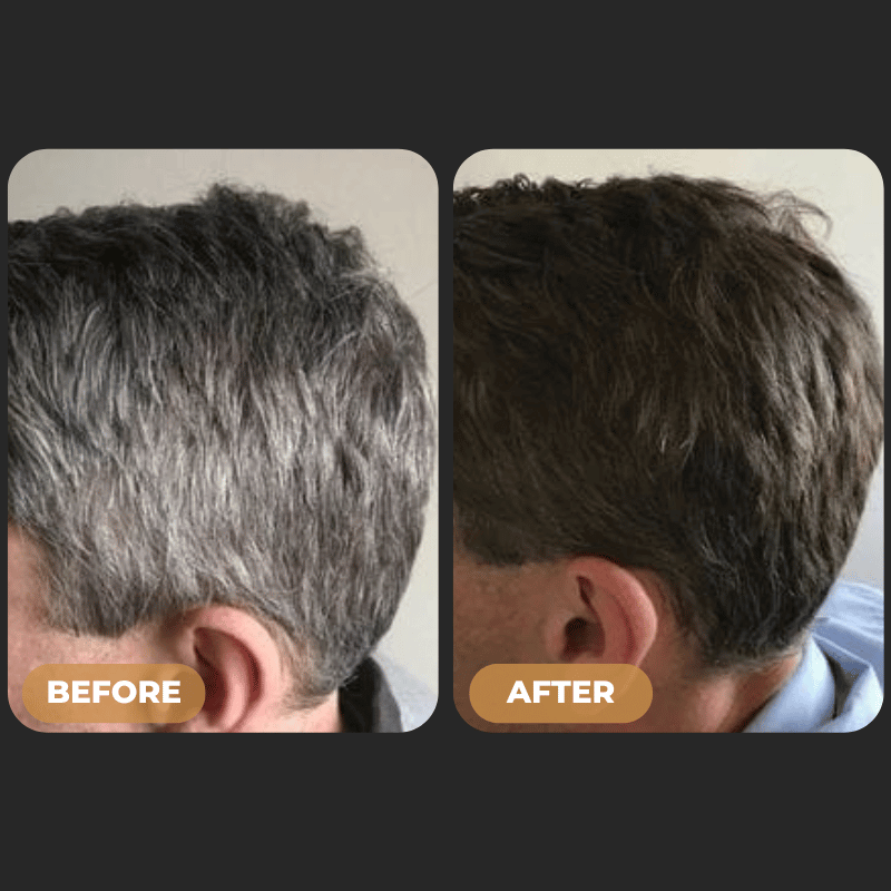 SPARTAN™ - Gray Hair Reverse Bar