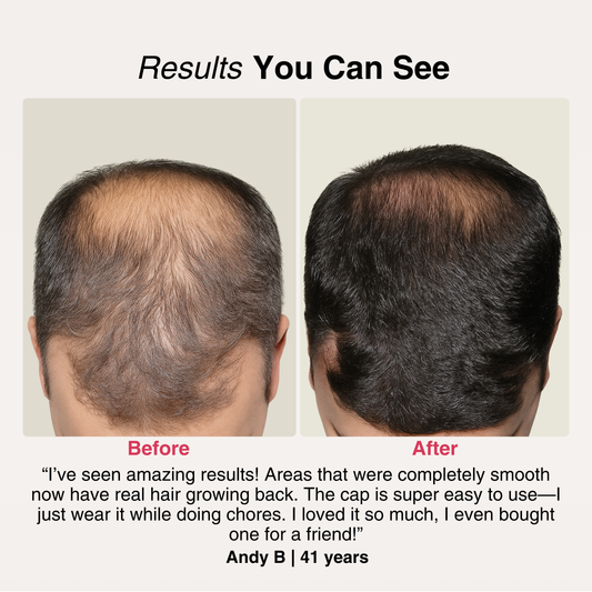 Red Light Growth Cap